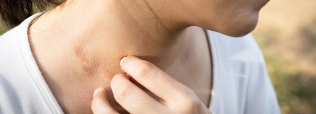 عکس بثورات پوستی