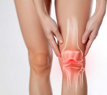 آرتریت سپتیک
