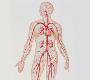 Takayasu's_arteritis