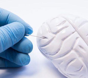 بیماری آنسفالیت لیمبیک