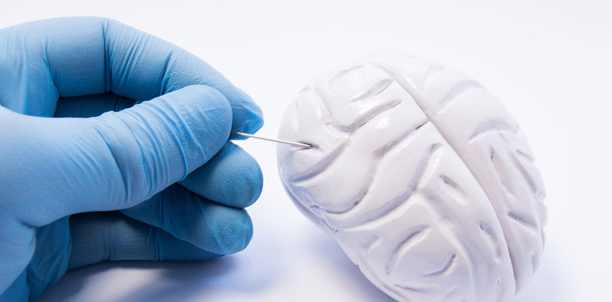 بیماری آنسفالیت لیمبیک