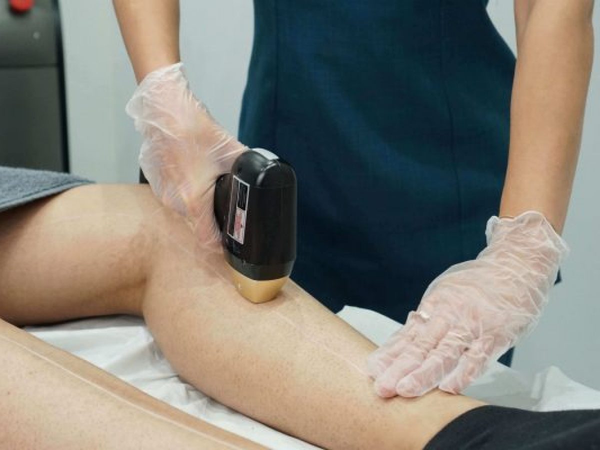 لیزر موهای زائد برای بیمارهای روماتیسم