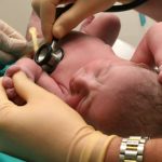 لوپوس نوزادی