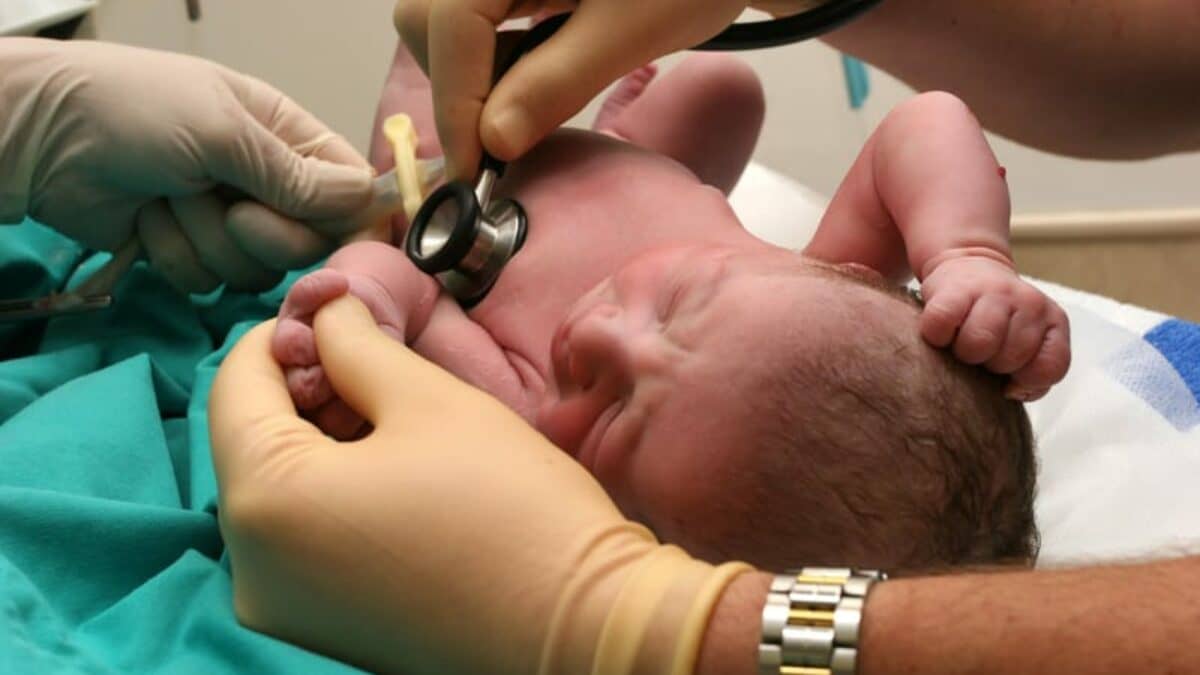 لوپوس نوزادی