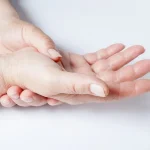 اسکلروداکتیلی