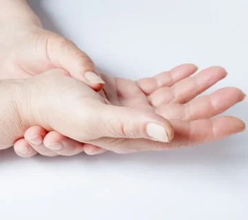 اسکلروداکتیلی