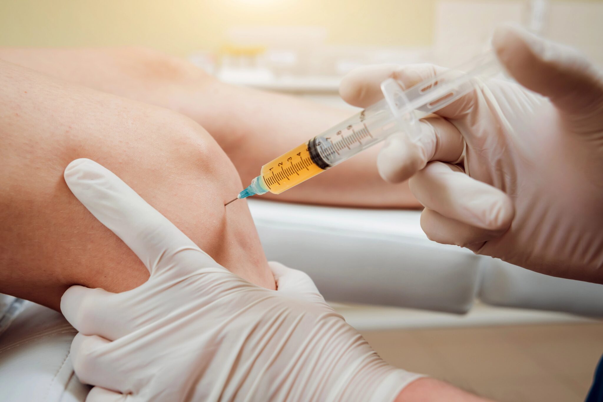 مقایسه درمان PRP با تزریق ژل در مفاصل